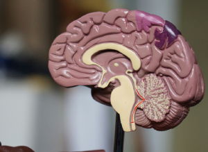 Plastic model of a brain